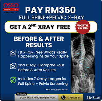 Digital Xray Free Comparison Promotion